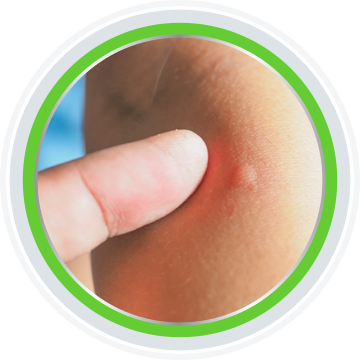 Newborn baby sleeping well after nappy rash cream was applied.